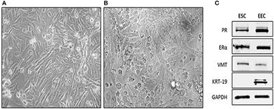 Ulipristal Acetate Interferes With Actin Remodeling Induced by 17β-Estradiol and Progesterone in Human Endometrial Stromal Cells